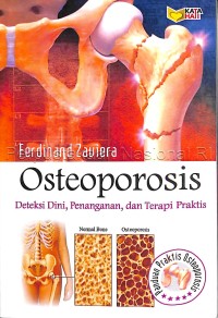 Osteoporosis, deteksi dini, penanganan, dan terapi praktis